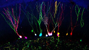 RGB-traced newborn granule cells (from Gomez-Nicola et al., Sci Rep 2015)     